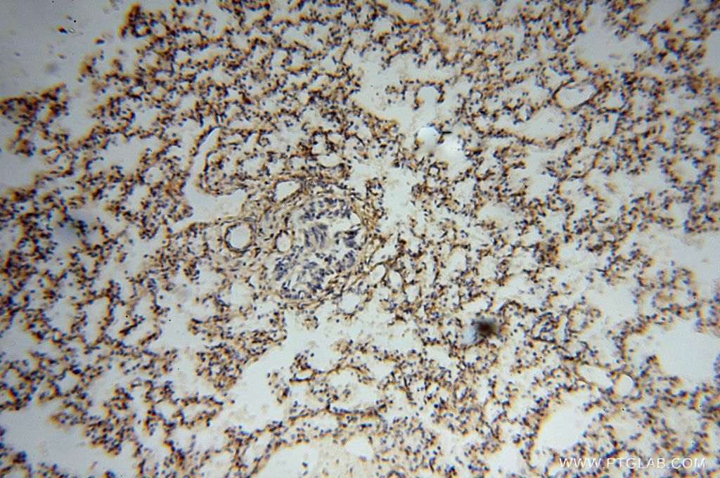 Immunohistochemistry (IHC) staining of human lung tissue using Septin 11 Polyclonal antibody (14672-1-AP)