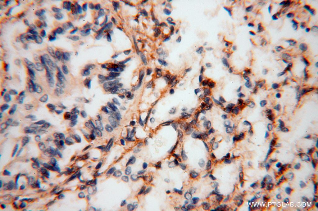 Immunohistochemistry (IHC) staining of human lung tissue using Septin 11 Polyclonal antibody (14672-1-AP)