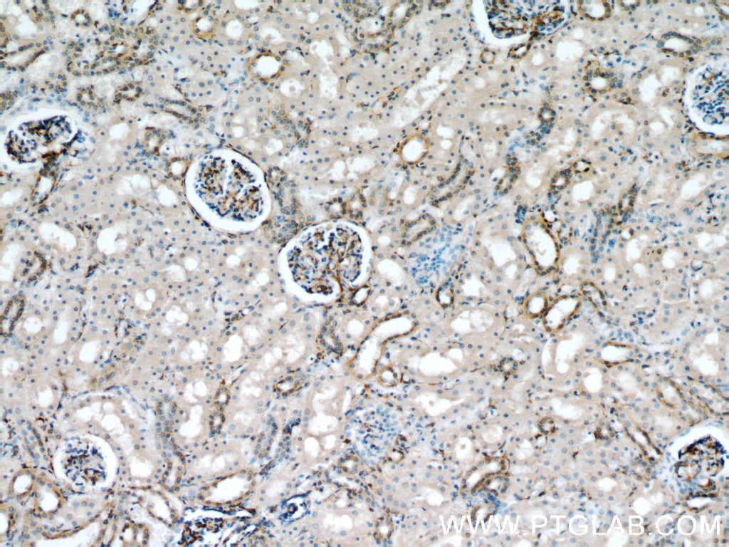 Immunohistochemistry (IHC) staining of human kidney tissue using Septin 11 Polyclonal antibody (14672-1-AP)