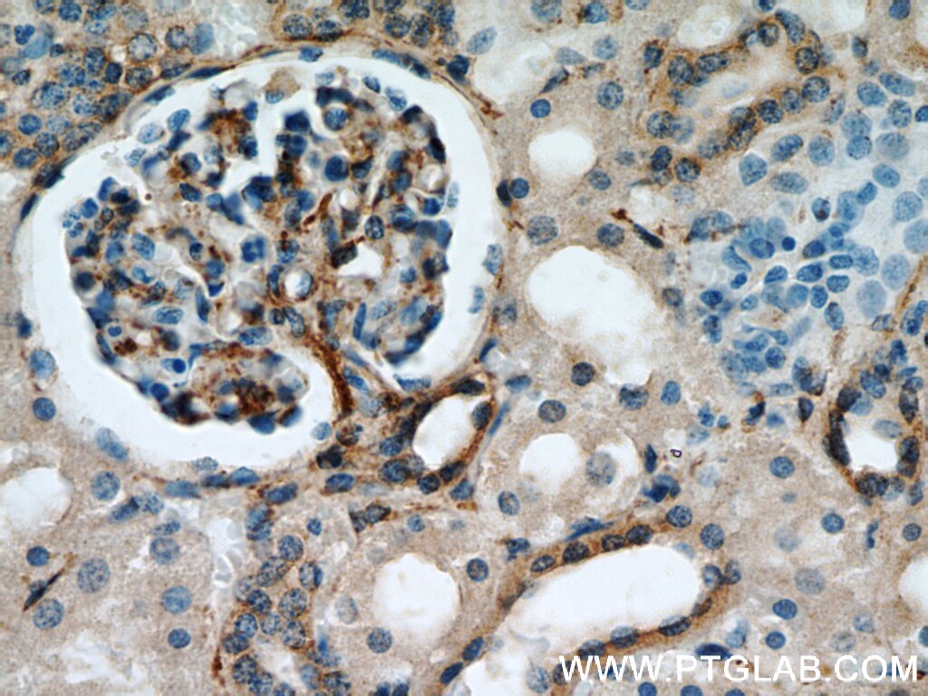 Immunohistochemistry (IHC) staining of human kidney tissue using Septin 11 Polyclonal antibody (14672-1-AP)