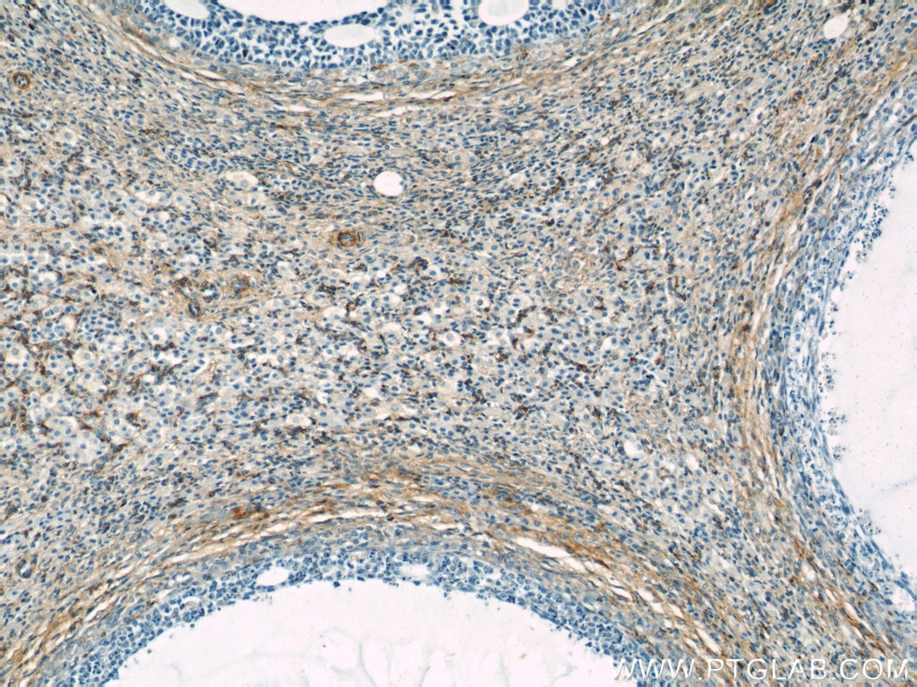 Immunohistochemistry (IHC) staining of human ovary tissue using Septin 11 Polyclonal antibody (14672-1-AP)