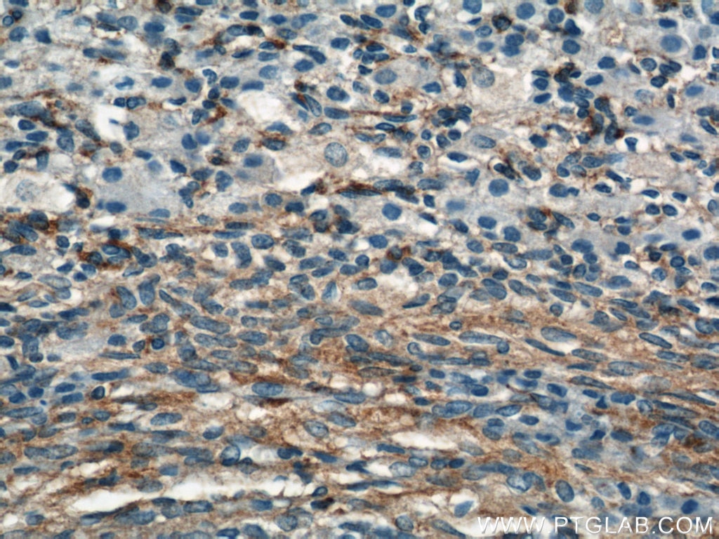 Immunohistochemistry (IHC) staining of human ovary tissue using Septin 11 Polyclonal antibody (14672-1-AP)