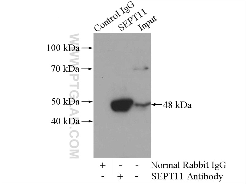 Immunoprecipitation (IP) experiment of mouse brain tissue using Septin 11 Polyclonal antibody (14672-1-AP)