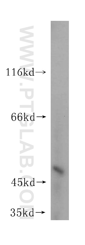 Western Blot (WB) analysis of human brain tissue using Septin 11 Polyclonal antibody (14672-1-AP)