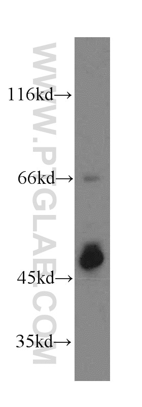 Western Blot (WB) analysis of mouse brain tissue using Septin 11 Polyclonal antibody (14672-1-AP)