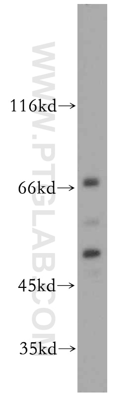 Western Blot (WB) analysis of HeLa cells using Septin 11 Polyclonal antibody (14672-1-AP)