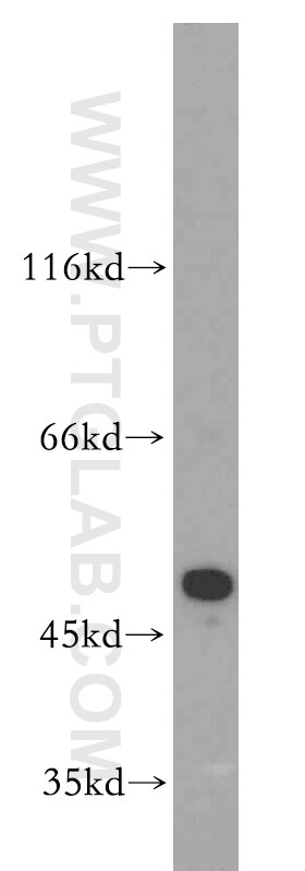 Western Blot (WB) analysis of HT-1080 cells using Septin 11 Polyclonal antibody (14672-1-AP)