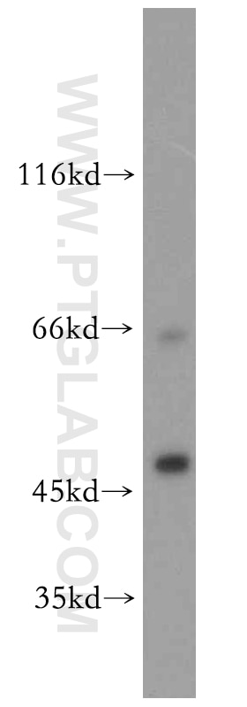 Western Blot (WB) analysis of mouse small intestine tissue using Septin 11 Polyclonal antibody (14672-1-AP)