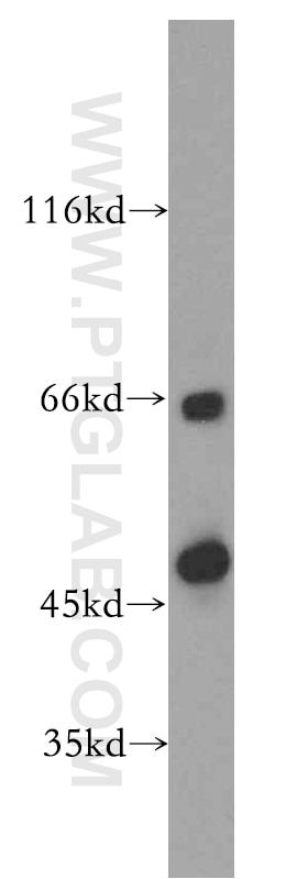 Western Blot (WB) analysis of mouse colon tissue using Septin 11 Polyclonal antibody (14672-1-AP)