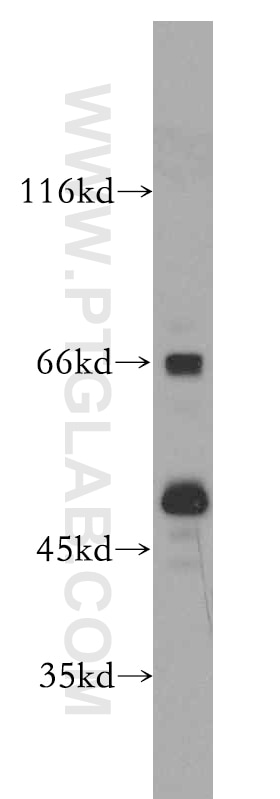 Western Blot (WB) analysis of SH-SY5Y cells using Septin 11 Polyclonal antibody (14672-1-AP)