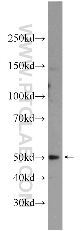 Western Blot (WB) analysis of mouse testis tissue using Septin 14 Polyclonal antibody (24590-1-AP)