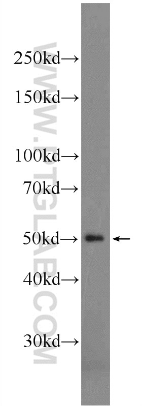 Western Blot (WB) analysis of rat testis tissue using Septin 14 Polyclonal antibody (24590-1-AP)