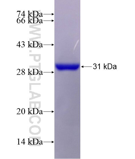 SEPT14 fusion protein Ag20181 SDS-PAGE