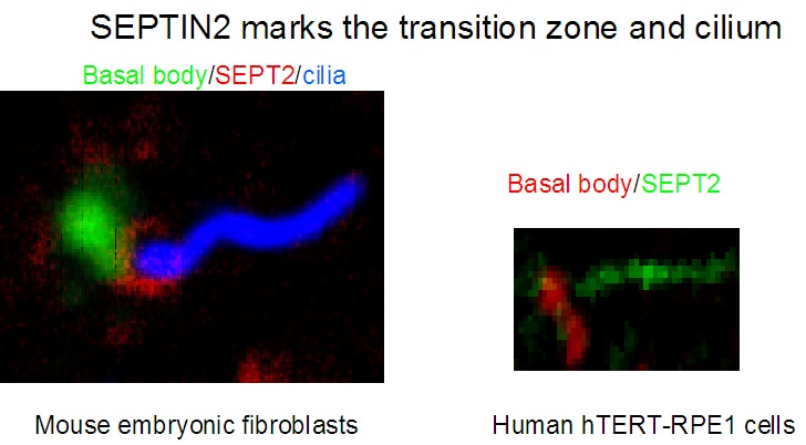 Immunofluorescence (IF) / fluorescent staining of hTERT-RPE1 cells and Mouse embryonic fibroblasts using Septin 2 Polyclonal antibody (11397-1-AP)