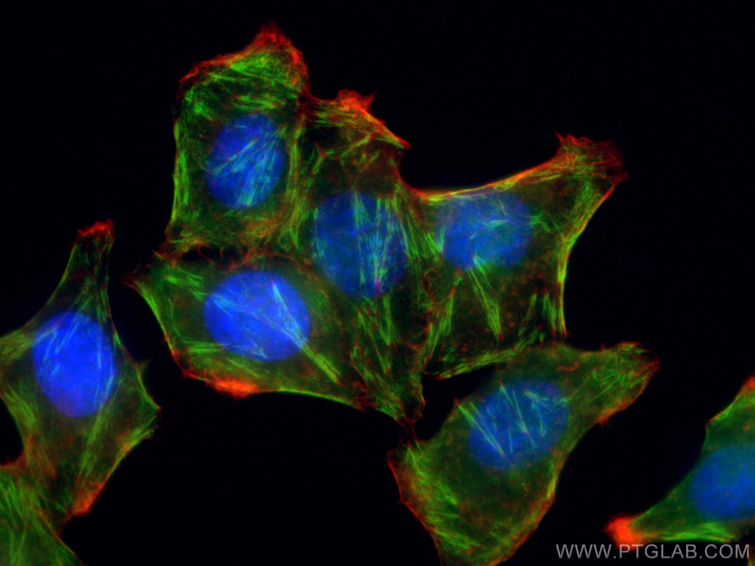 Immunofluorescence (IF) / fluorescent staining of HepG2 cells using Septin 2 Polyclonal antibody (11397-1-AP)