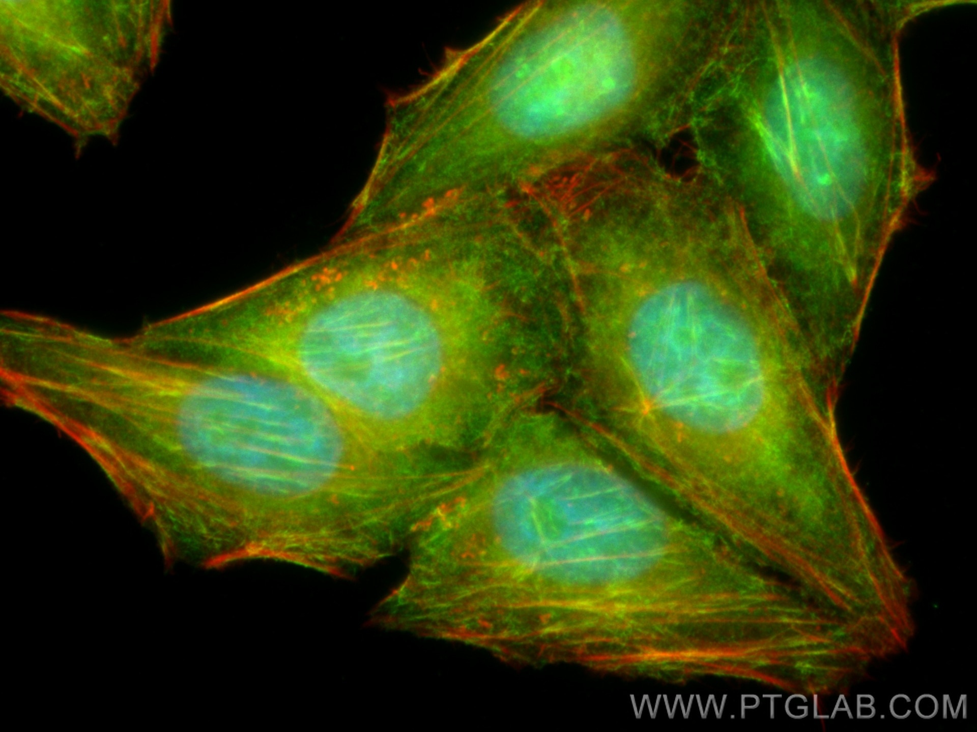 Immunofluorescence (IF) / fluorescent staining of HepG2 cells using Septin 2 Polyclonal antibody (11397-1-AP)
