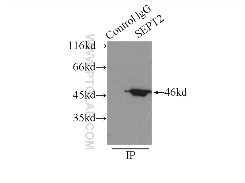 Immunoprecipitation (IP) experiment of mouse brain tissue using Septin 2 Polyclonal antibody (11397-1-AP)