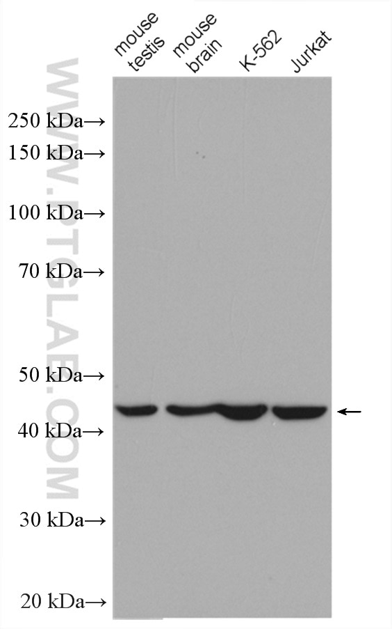 Western Blot (WB) analysis of various lysates using Septin 2 Polyclonal antibody (11397-1-AP)