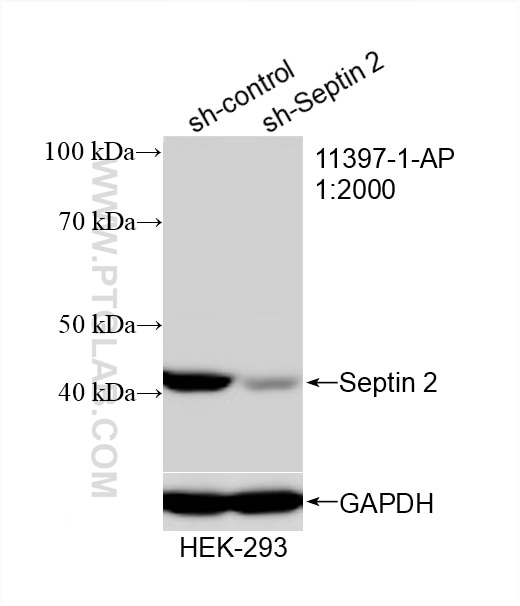 Western Blot (WB) analysis of HEK-293 cells using Septin 2 Polyclonal antibody (11397-1-AP)