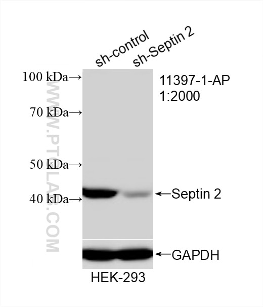 WB analysis of HEK-293 using 11397-1-AP