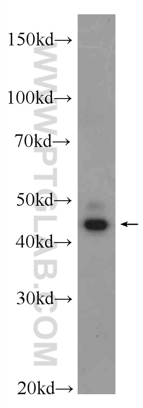 Western Blot (WB) analysis of rat brain tissue using Septin 2 Polyclonal antibody (11397-1-AP)