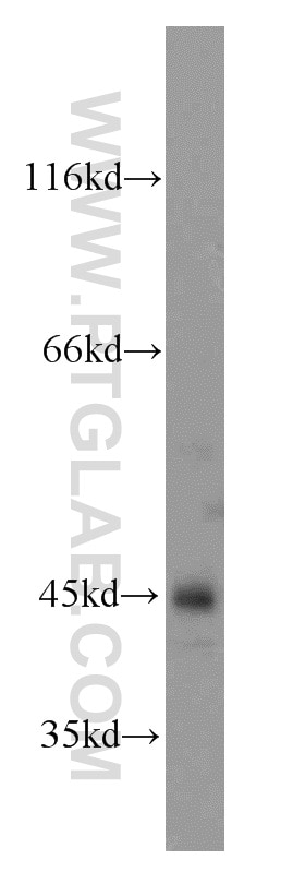 WB analysis of mouse heart using 11397-1-AP