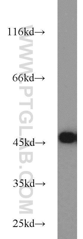 Western Blot (WB) analysis of HeLa cells using Septin 2 Polyclonal antibody (11397-1-AP)