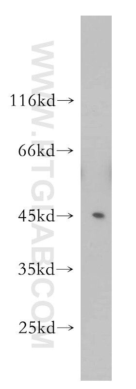 Western Blot (WB) analysis of human skeletal muscle tissue using Septin 2 Polyclonal antibody (11397-1-AP)