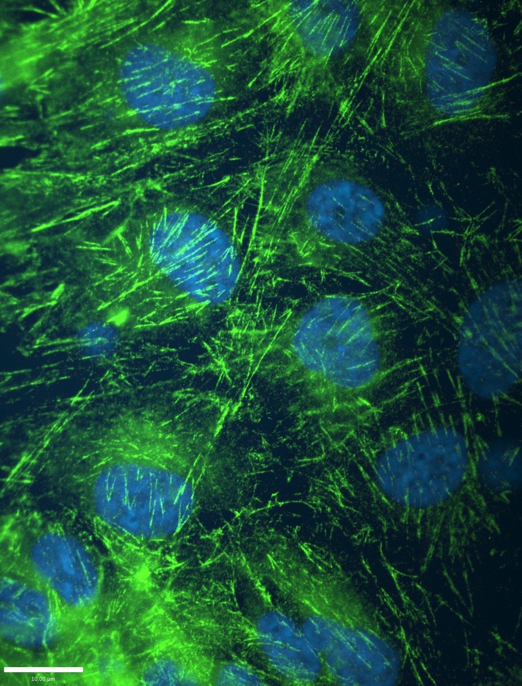 Immunofluorescence (IF) / fluorescent staining of hTERT-RPE cells using Septin 2 Monoclonal antibody (60075-1-Ig)