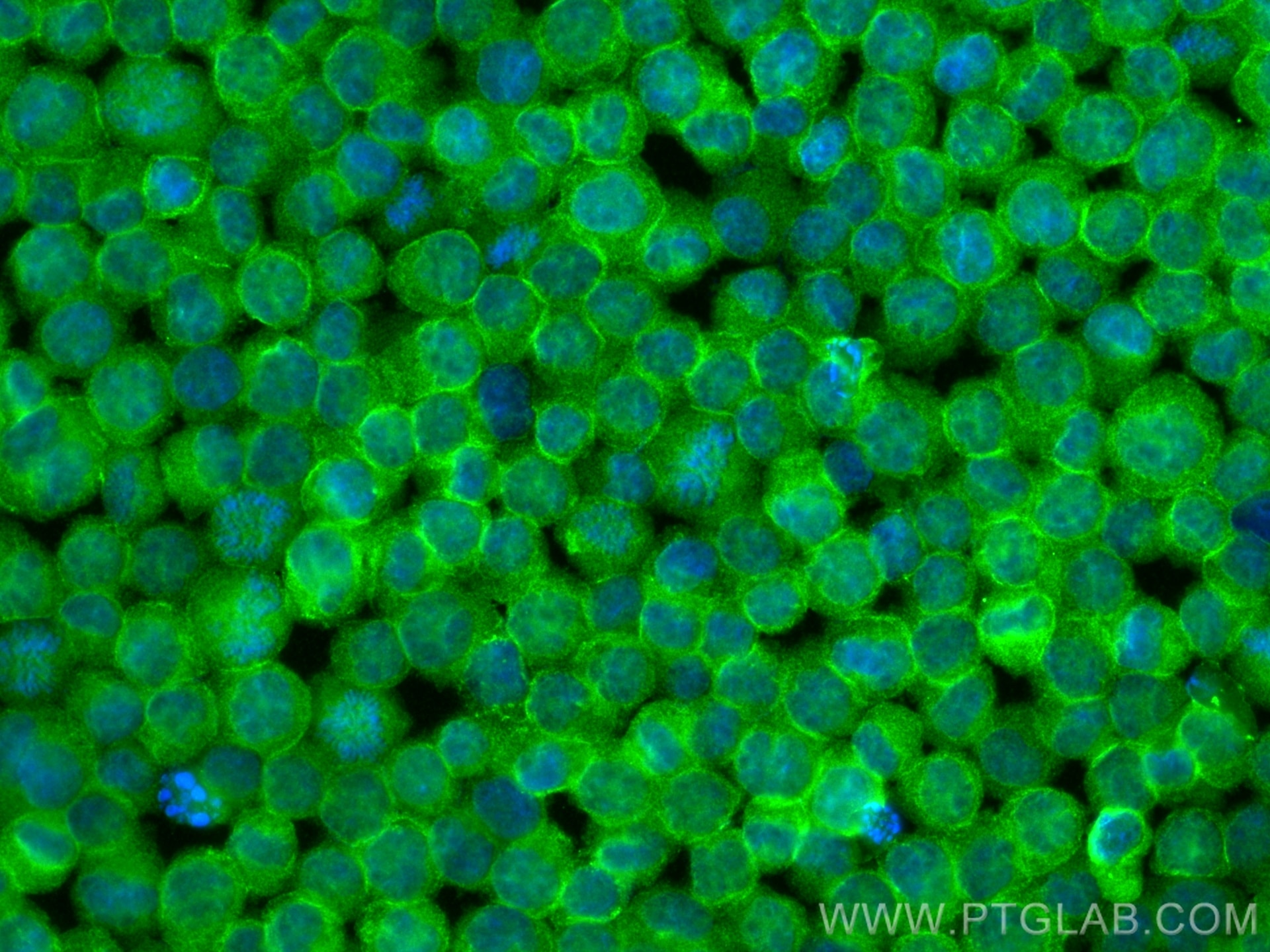 Immunofluorescence (IF) / fluorescent staining of K-562 cells using Septin 2 Monoclonal antibody (60075-1-Ig)