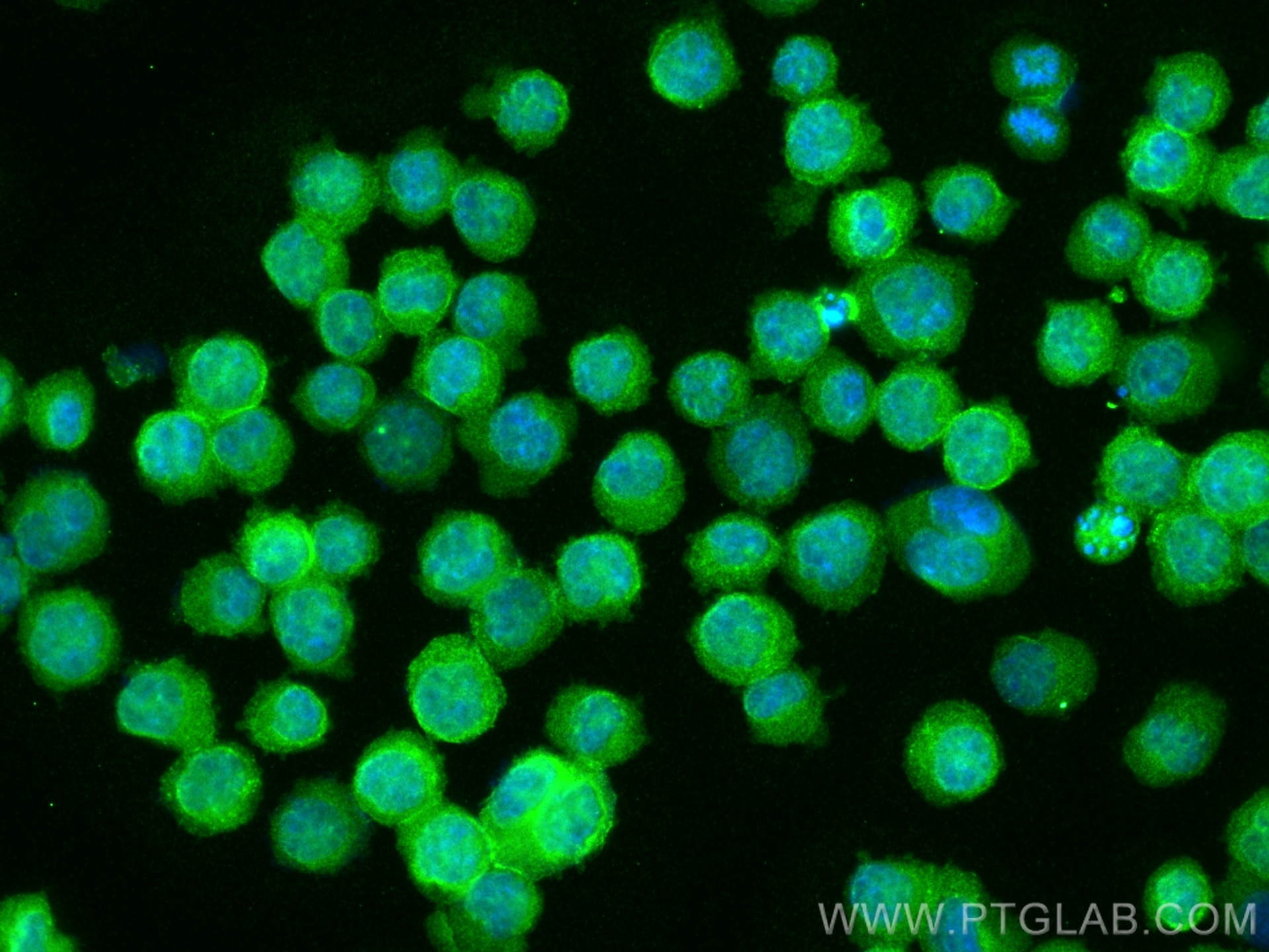 Immunofluorescence (IF) / fluorescent staining of K-562 cells using Septin 2 Monoclonal antibody (60075-1-Ig)