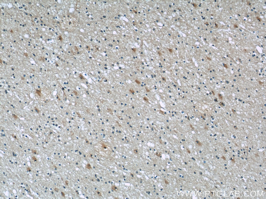 Immunohistochemistry (IHC) staining of human brain tissue using Septin 2 Monoclonal antibody (60075-1-Ig)