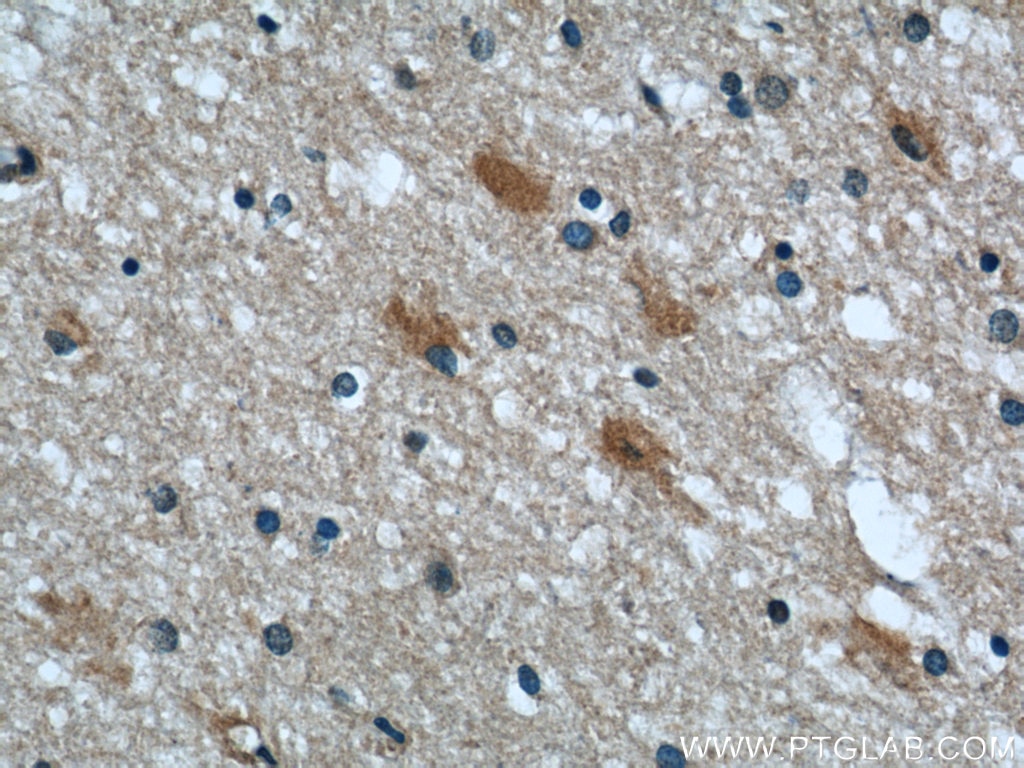 IHC staining of human brain using 60075-1-Ig