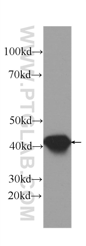 Western Blot (WB) analysis of Jurkat cells using Septin 2 Monoclonal antibody (60075-1-Ig)