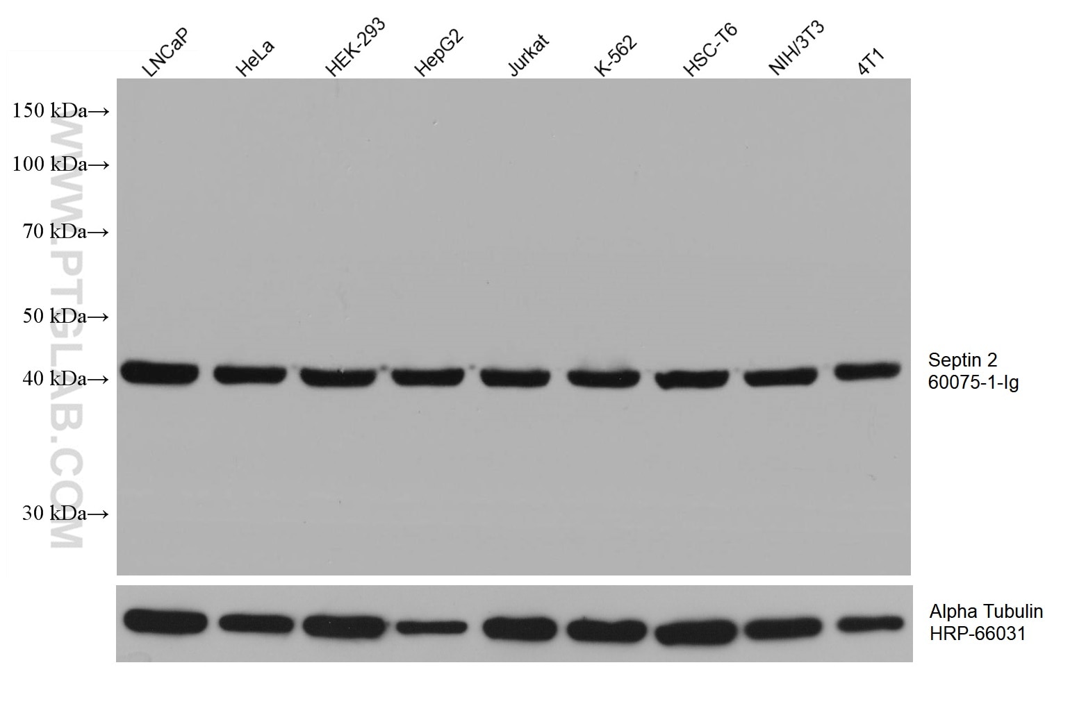 Western Blot (WB) analysis of various lysates using Septin 2 Monoclonal antibody (60075-1-Ig)