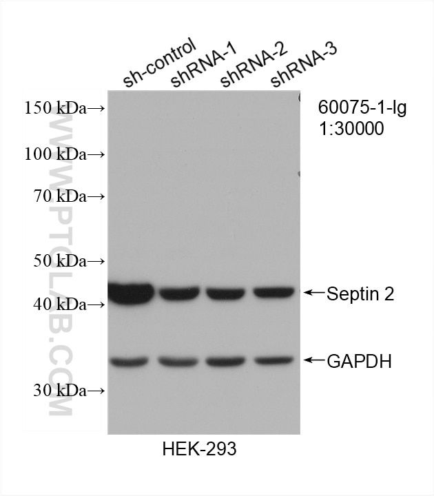 Western Blot (WB) analysis of HEK-293 cells using Septin 2 Monoclonal antibody (60075-1-Ig)