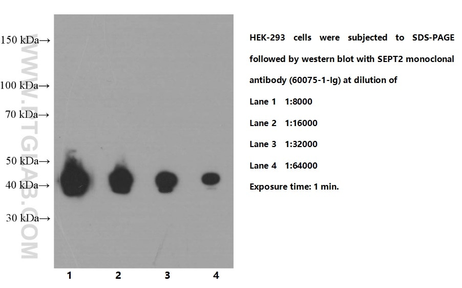 Western Blot (WB) analysis of HEK-293 cells using Septin 2 Monoclonal antibody (60075-1-Ig)