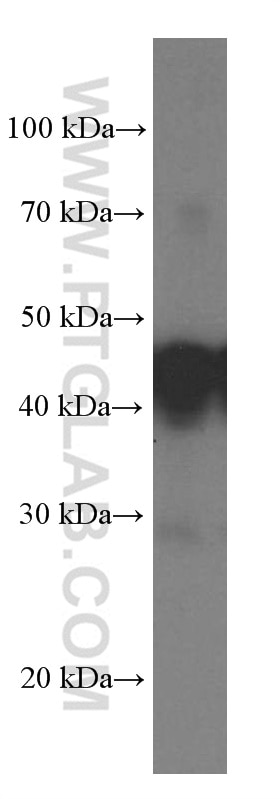 Western Blot (WB) analysis of fetal human brain tissue using Septin 2 Monoclonal antibody (60075-1-Ig)