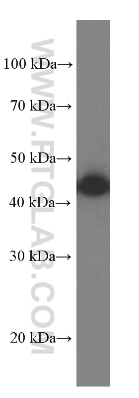 Western Blot (WB) analysis of HeLa cells using Septin 2 Monoclonal antibody (60075-1-Ig)