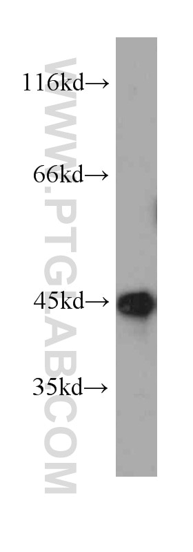 Western Blot (WB) analysis of human brain tissue using Septin 2 Monoclonal antibody (60075-1-Ig)