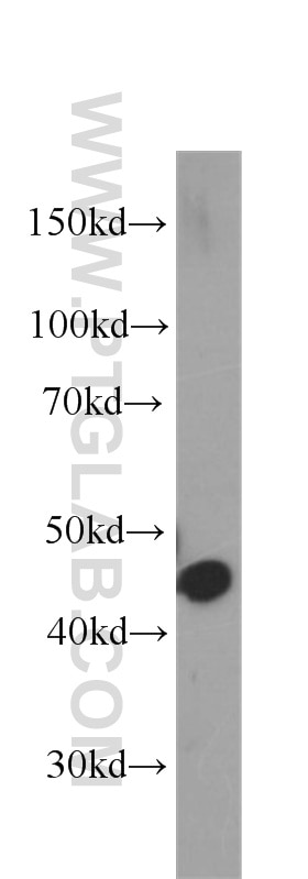 Western Blot (WB) analysis of human testis tissue using Septin 2 Monoclonal antibody (60075-1-Ig)