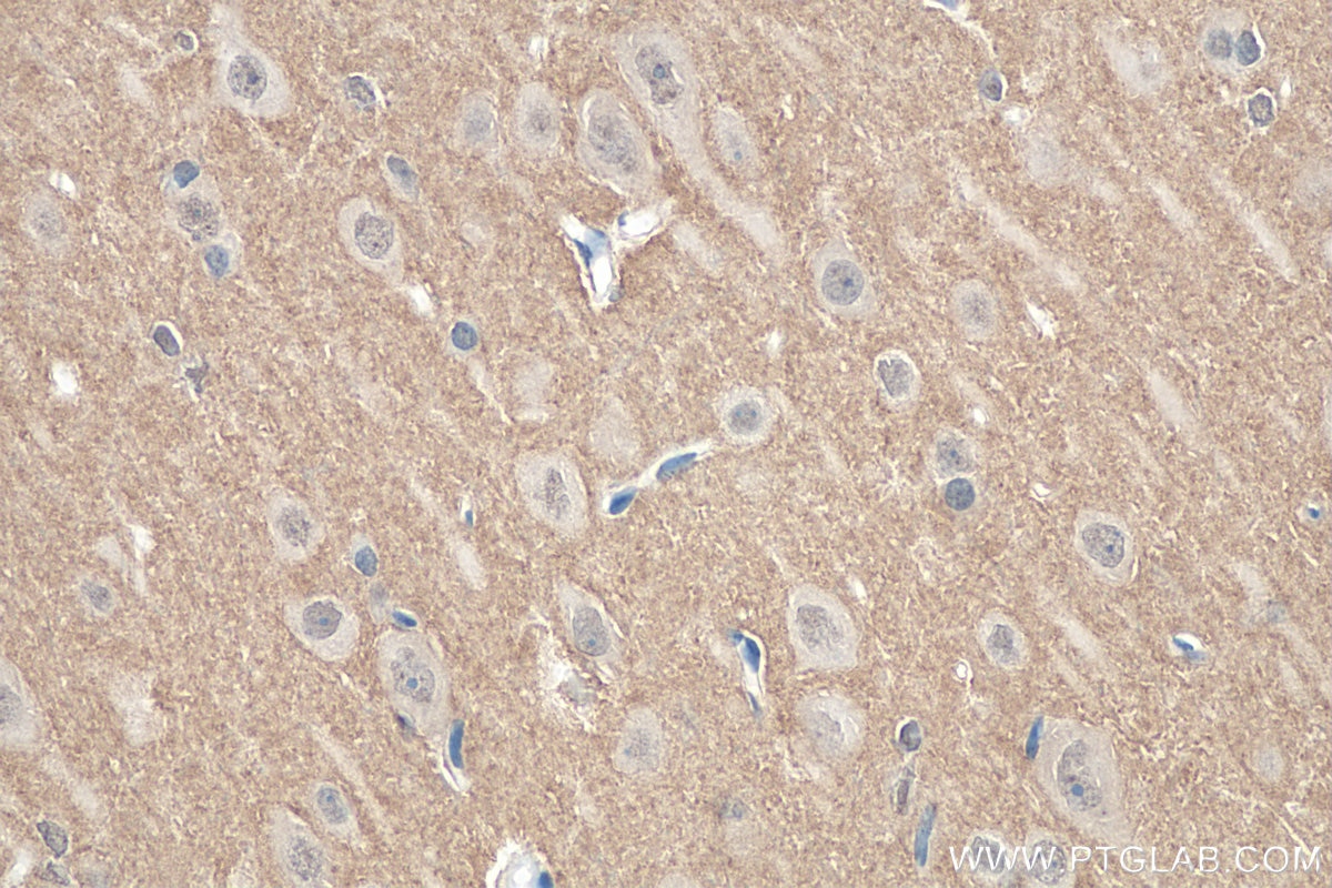 Immunohistochemistry (IHC) staining of rat brain tissue using SEPT3 Polyclonal antibody (30146-1-AP)