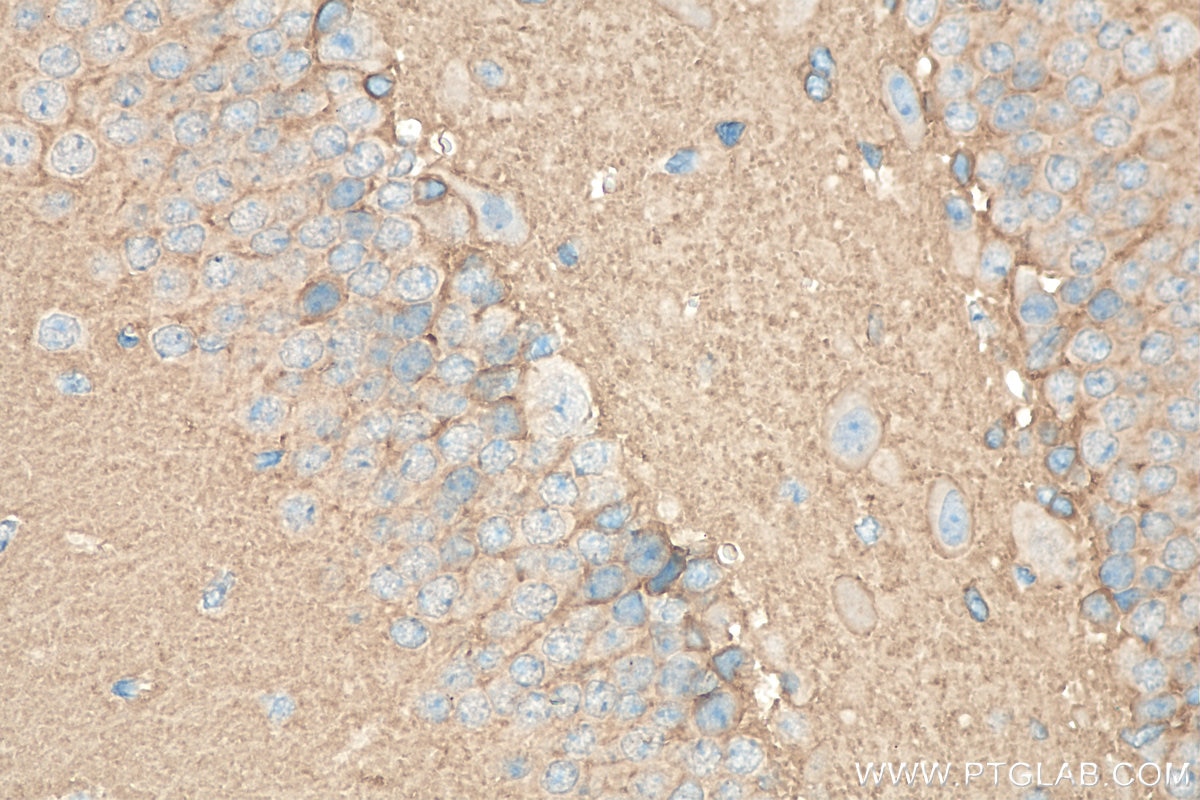 Immunohistochemistry (IHC) staining of mouse brain tissue using SEPT3 Polyclonal antibody (30146-1-AP)