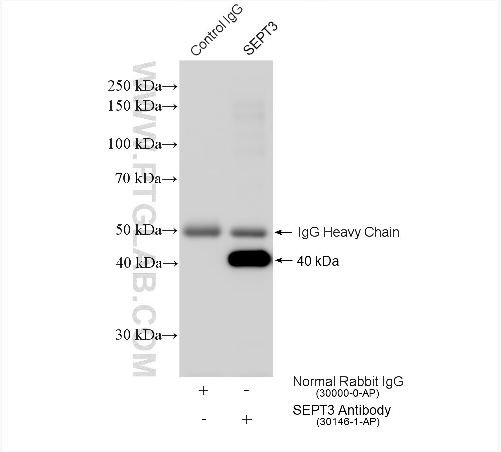 Immunoprecipitation (IP) experiment of mouse brain tissue using SEPT3 Polyclonal antibody (30146-1-AP)