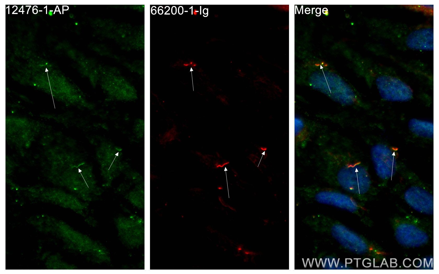 Immunofluorescence (IF) / fluorescent staining of hTERT-RPE1 cells using Septin 4 Polyclonal antibody (12476-1-AP)
