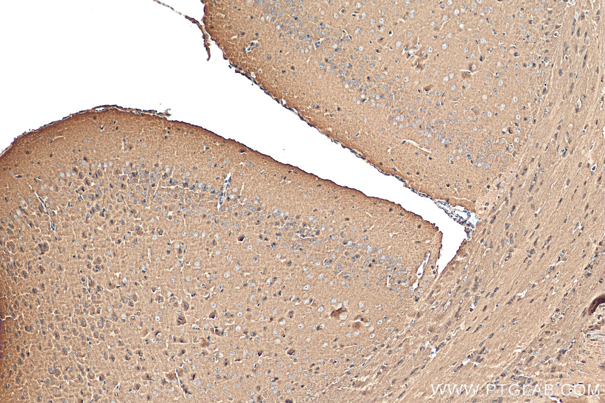 Immunohistochemistry (IHC) staining of mouse brain tissue using Septin 4 Polyclonal antibody (12476-1-AP)