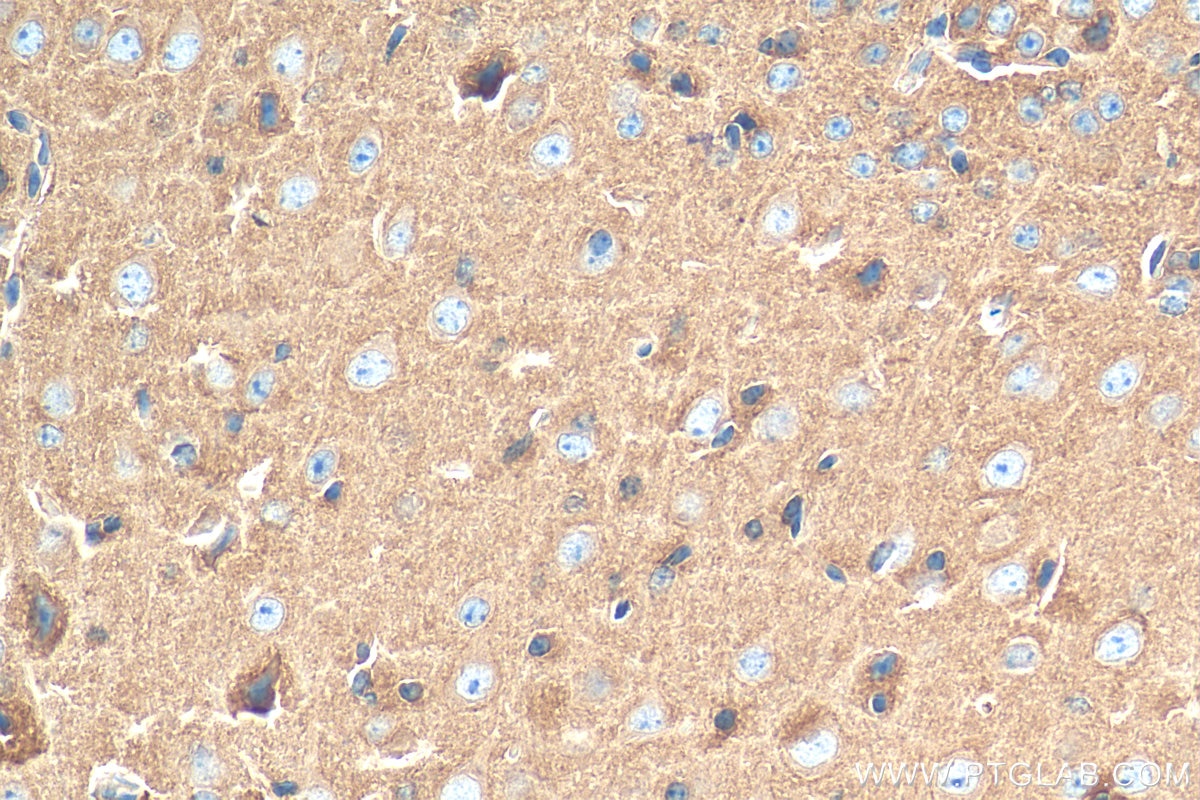 Immunohistochemistry (IHC) staining of mouse brain tissue using Septin 4 Polyclonal antibody (12476-1-AP)