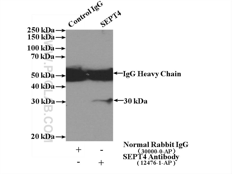 Immunoprecipitation (IP) experiment of A375 cells using Septin 4 Polyclonal antibody (12476-1-AP)