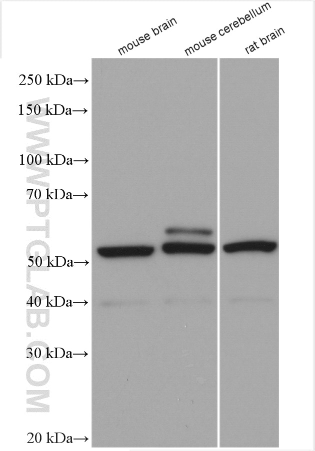Western Blot (WB) analysis of various lysates using Septin 4 Polyclonal antibody (12476-1-AP)
