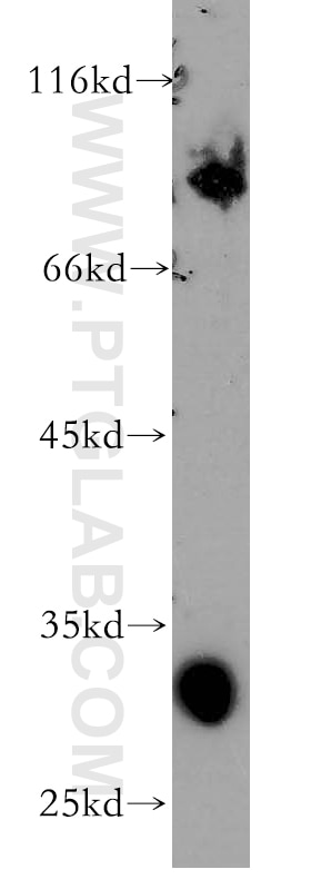 Western Blot (WB) analysis of A375 cells using Septin 4 Polyclonal antibody (12476-1-AP)